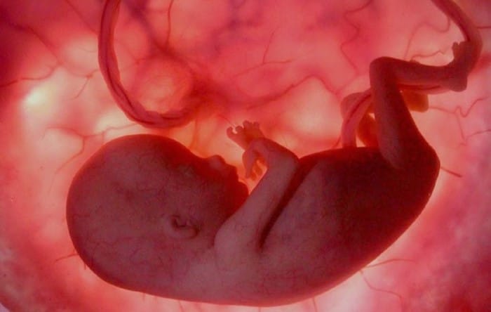 Feto_de_6_mese