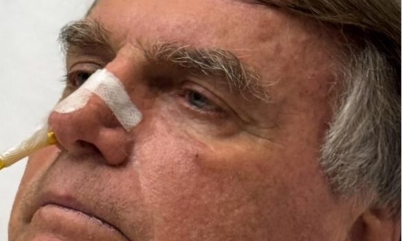 Médicos indicam cirurgia para Bolsonaro após exames; duas hérnias inguinais