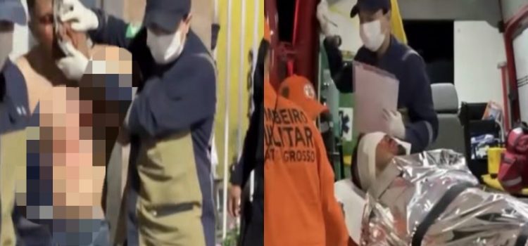 BANHO DE SANGUE: Morador sai pra ver barulho e acaba baleado no olho por faccionado em MT; vídeo forte