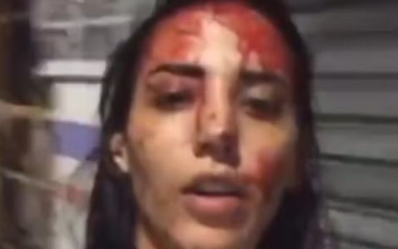 Jovem esfaqueia o ex por sofrer agressões e grava vídeo banhada em sangue: ‘Tô indo presa, feliz’