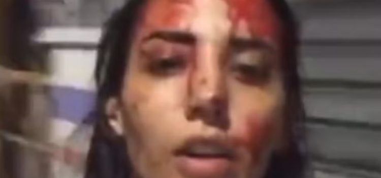 Jovem esfaqueia o ex por sofrer agressões e grava vídeo banhada em sangue: ‘Tô indo presa, feliz’