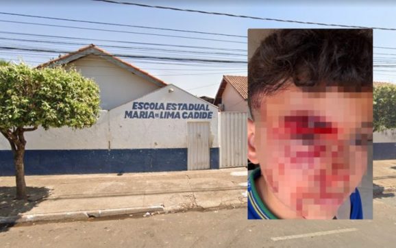 Criança é espancada dentro de Escola Estadual em Rondonópolis; veja
