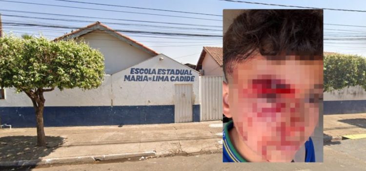 Criança é espancada dentro de Escola Estadual em Rondonópolis; veja