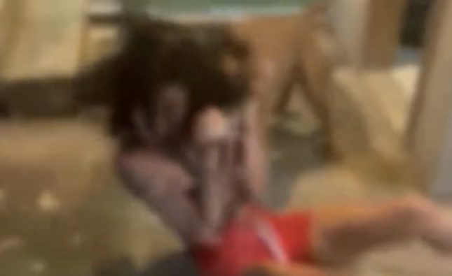 VÍDEO FORTE | Mãe manda pitbull atacar filha após descobrir que ela é do ‘job’; graves ferimentos