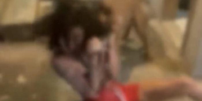 VÍDEO FORTE | Mãe manda pitbull atacar filha após descobrir que ela é do ‘job’; graves ferimentos