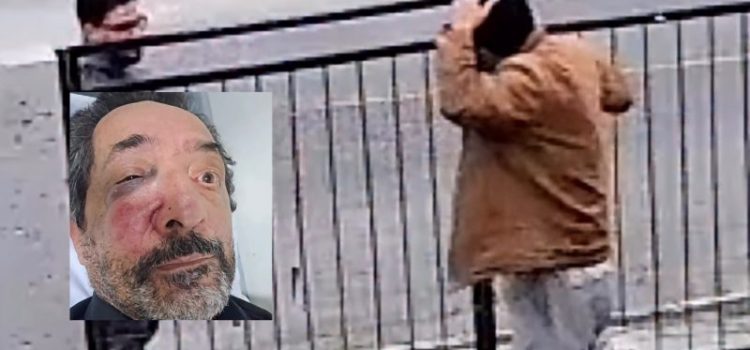 Idoso tem casa invadida, acaba espancado, reage a tiros e caso termina no Hospital Regional; vítima ainda foi presa