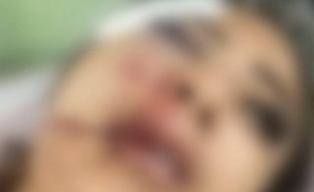 Garota de programa fica desacordada após ser brutalmente espancada por cliente em MT; vídeo forte