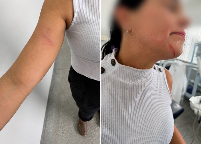 Paciente surtada briga com médica grávida, agride auxiliar e faz ameaça de morte em Rondonópolis