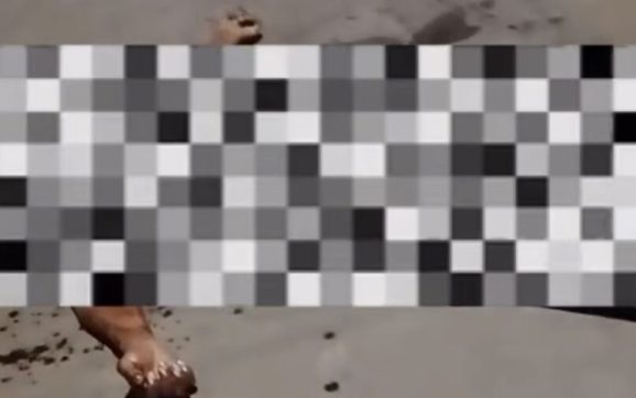 Briga de bar termina com garrafada e homem gravemente ferido na UPA; vídeo forte