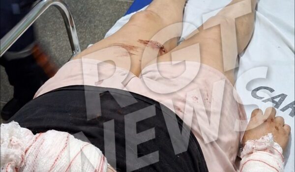 Mulher é atacada por cão durante passeio e sofre mordidas pelo corpo em Rondonópolis; imagens