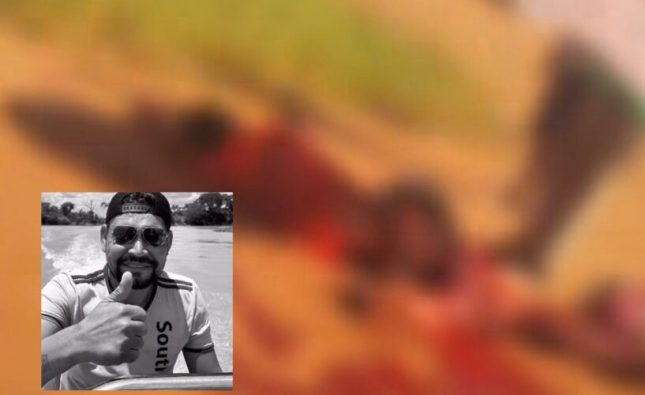Homem morre no Hospital Regional após sofrer grave acidente e ter perna amputada; vídeo forte