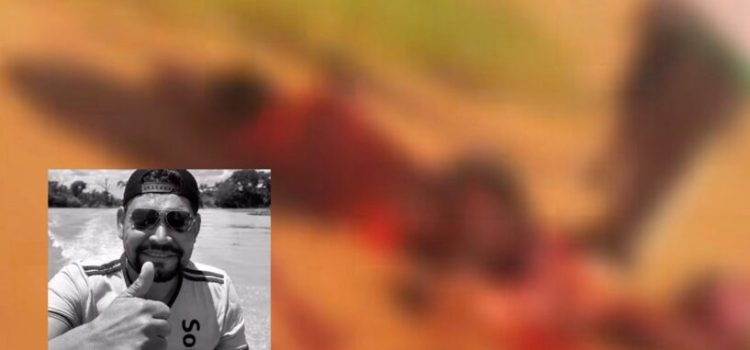 Homem morre no Hospital Regional após sofrer grave acidente e ter perna amputada; vídeo forte