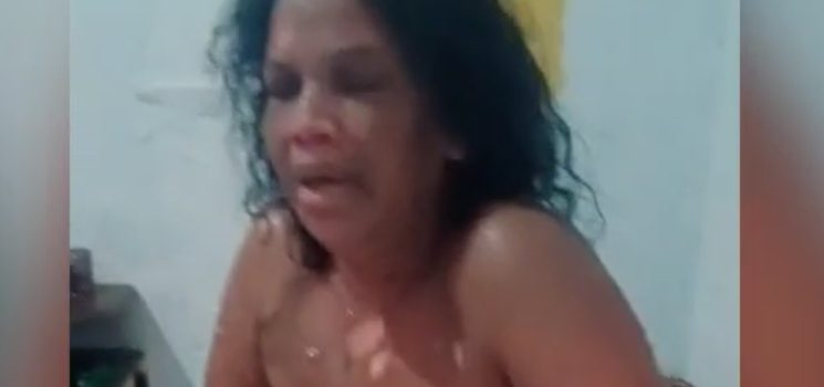 Homem joga água quente e ateia fogo na própria esposa durante discussão; vídeo forte