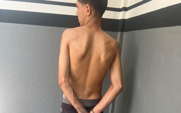 Mulher é submetida a 30 dias de tortura, com estupros, agressões e cabelo cortado à faca em MT
