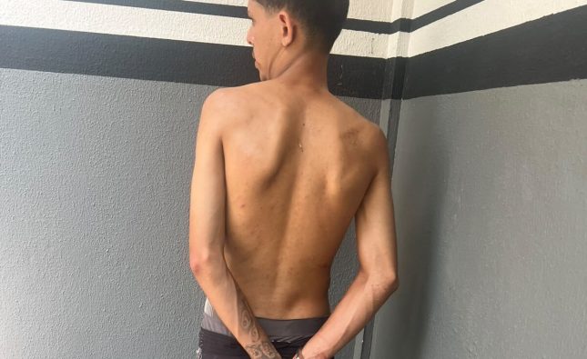 Mulher é submetida a 30 dias de tortura, com estupros, agressões e cabelo cortado à faca em MT