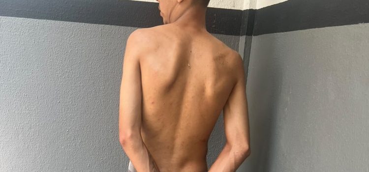 Mulher é submetida a 30 dias de tortura, com estupros, agressões e cabelo cortado à faca em MT