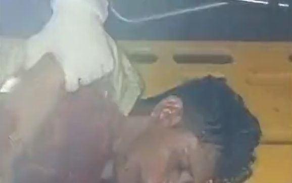 VÍDEO | Homem acusado de ser X-9 é torturado por faccionados e deixado para morrer; vítima teve língua cortada