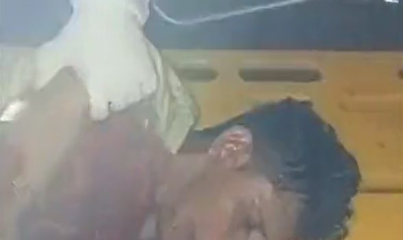 VÍDEO | Homem acusado de ser X-9 é torturado por faccionados e deixado para morrer; vítima teve língua cortada