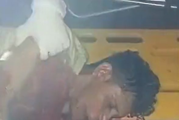 VÍDEO | Homem acusado de ser X-9 é torturado por faccionados e deixado para morrer; vítima teve língua cortada