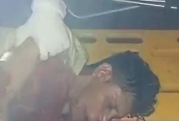 VÍDEO | Homem acusado de ser X-9 é torturado por faccionados e deixado para morrer; vítima teve língua cortada