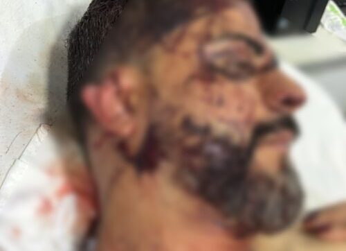 Vereador alvo de ataque brutal volta a ser hospitalizado em Rondonópolis