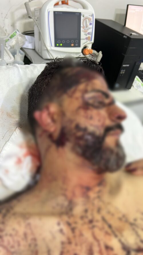 Vereador alvo de ataque brutal volta a ser hospitalizado em Rondonópolis
